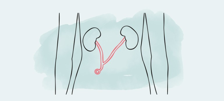 Urostoma
