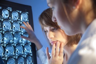 Schlaganfall Diagnose