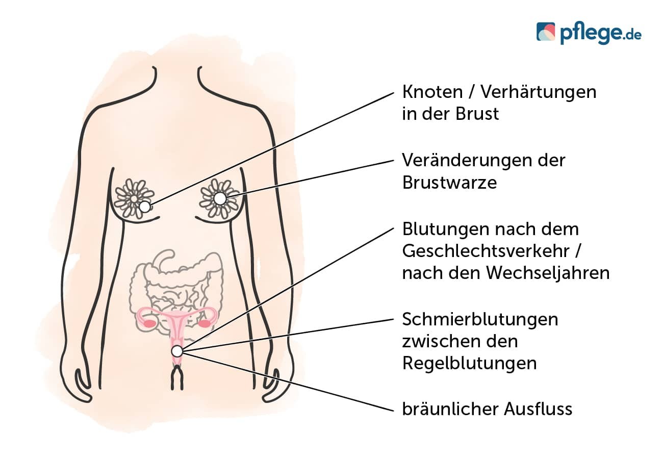 Mögliche Anzeichen für eine Krebserkrankung im weiblichen Körper