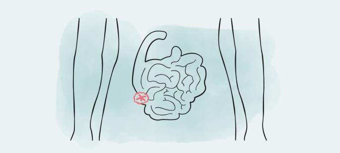 Enterostoma